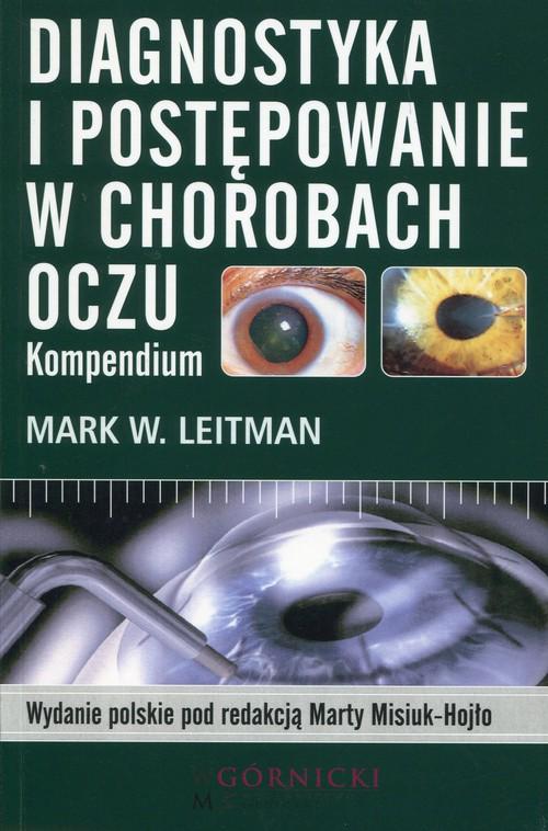 

Diagnostyka i postępowanie w chorobach oczu Kompen