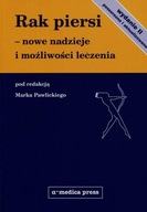 Rak piersi nowe nadzieje i możliwości leczenia Pawlicki Marek