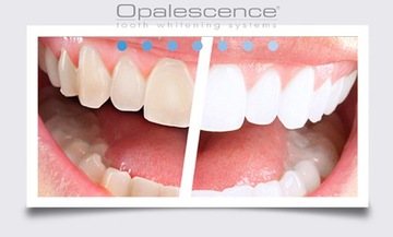 OPALESCENCE 4x% 16_4w1 SUPER ZESTAW WYBIELANIE USA