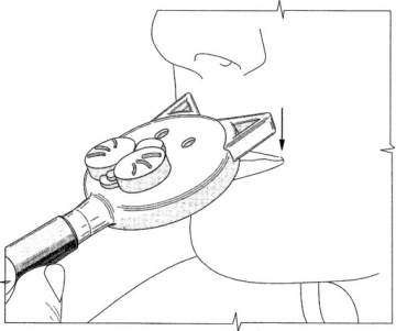 МАССАЖНЫЙ НАКОНЕЧНИК ARK ДЛЯ ЛОГОПЕДИЧЕСКОГО ВИБРАТОРА Z-VIBE REREK - МЫШЬ