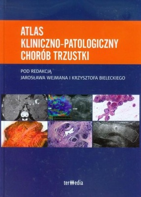 Atlas kliniczno - patologiczny chorób trzustki Wejman Bielecki Krzysztof