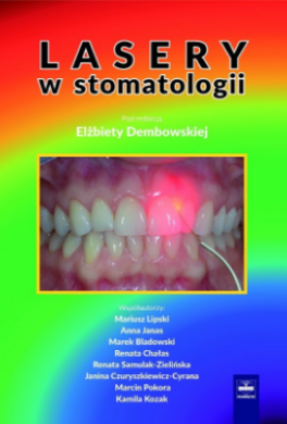 LASERY W STOMATOLOGII DEMBOWSKA TANIO!!!