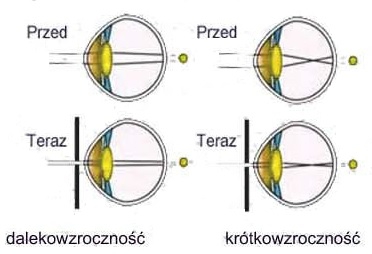 Аюрведические корректирующие очки VISION HEALING