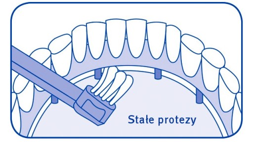 КУРАПРОКС ИМПЛАНТАТ И ОРТО-ПАКЕТНАЯ ЩЕТКА