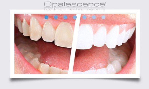 OPALESCENCE 4x% 16_4w1 SUPER ZESTAW WYBIELANIE USA